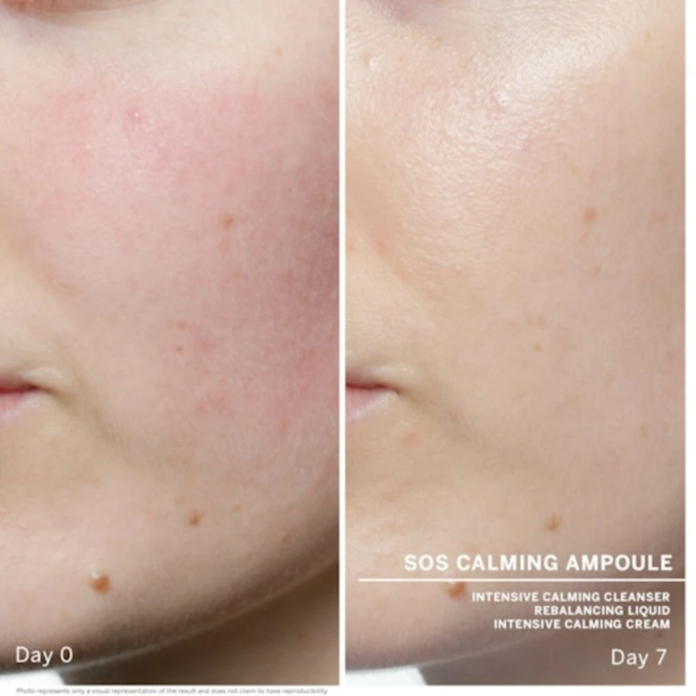 Babor SOS Calming Ampoule Concentrates 5 Babor SOS Calming Ampoule Concentrates - Afbeelding 3