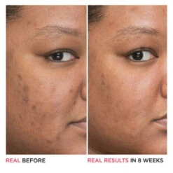 IT Cosmetics Bye Bye Dark Spots Niacinamide Serum -Garnier Winkel 1072751 6