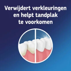3x Fixodent Reinigingstabletten Complete Care -Garnier Winkel 998573 3 1